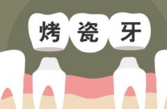 钴铬烤瓷牙和全瓷牙哪个好？区别在线一览+修复牙必看~