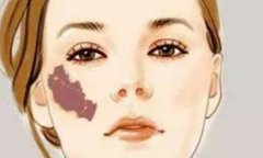 成都金牛区人民医院激光祛疤多少钱？下面就有价格分享和激光祛疤前应注意些什么？