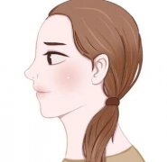 玻尿酸眉弓会不会下滑？玻尿酸眉弓手术风险和注意事项是什么？