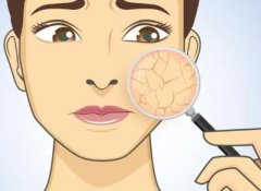 大拉皮手术效果好吗？大拉皮手术有哪些特点？