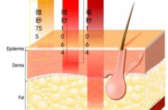 5d胶原光原理是什么？5d胶原光多久能做一次？