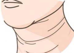 有效除皱的食物有哪些？皱纹的形成是怎么样子的？