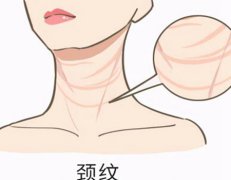 广西皮肤病医院有注射除皱吗？注射除皱技术优势和美容科室简介！