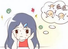 杭州第三人民医院激光祛痘多少钱？