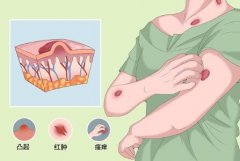 上海疤痕修复医生哪家好？