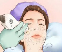 湘乡人民医院可以做热玛吉吗？多少钱？