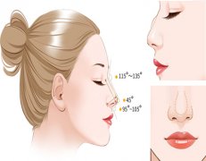 郑州隆鼻医院排名前三有哪些？