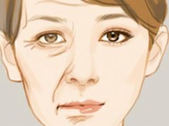 镇江中西医结合医院黄金微针怎么样？