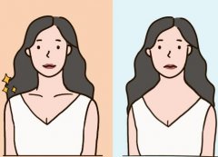 斜方肌为什么会变大？