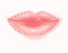 唇周黑怎么消除？