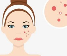 枣庄市立医院治痤疮怎么样？