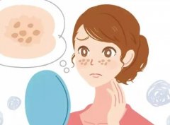 桂平人民医院激光美容怎么样？