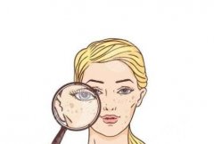 信宜人民医院祛斑多少钱？