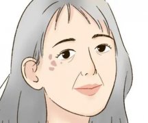 重庆合川区人民医院去胎记多少钱？怎么样？