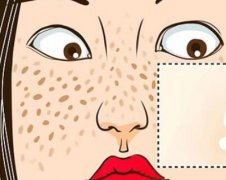 北京大学人民医院祛斑多少钱？