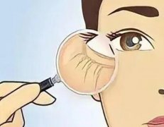 济宁中西医结合医院注射除皱怎么样？