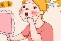 赤峰第二医院治痤疮怎么样？