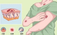 运城中心医院去疤痕怎么样？