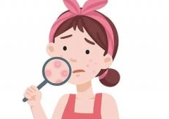 天水中西医结合医院祛痘印怎么样？多少钱？