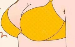 假体隆胸300cc做完后图片如何？