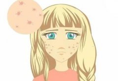 锦州中心医院治痤疮怎么样？