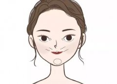 赤峰医院注射除皱怎么样？