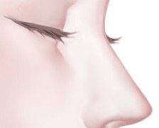 上海第九人民医院歪鼻矫正哪个医生技术好？