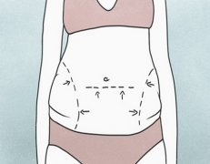 上海第九人民医院抽脂怎么样？