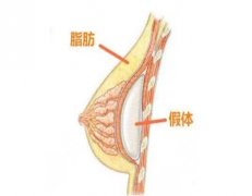 深圳市人民医院隆胸怎么样？