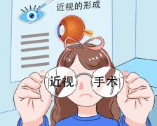 飞秒激光近视手术和晶体移植哪个好？进来看看两者的区别