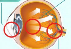 全飞秒对角膜曲率的要求是什么？好处都有哪些