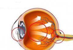 SMART手术和全飞秒有什么区别？哪些人不可以做屈光矫正手术