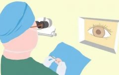 角膜屈光手术是什么？角膜屈光手术可以维持多久