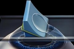 如何判断近视度数涨了？什么情况下可以激光矫正