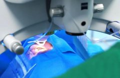 准分子激光有什么优缺点？项目如何护理